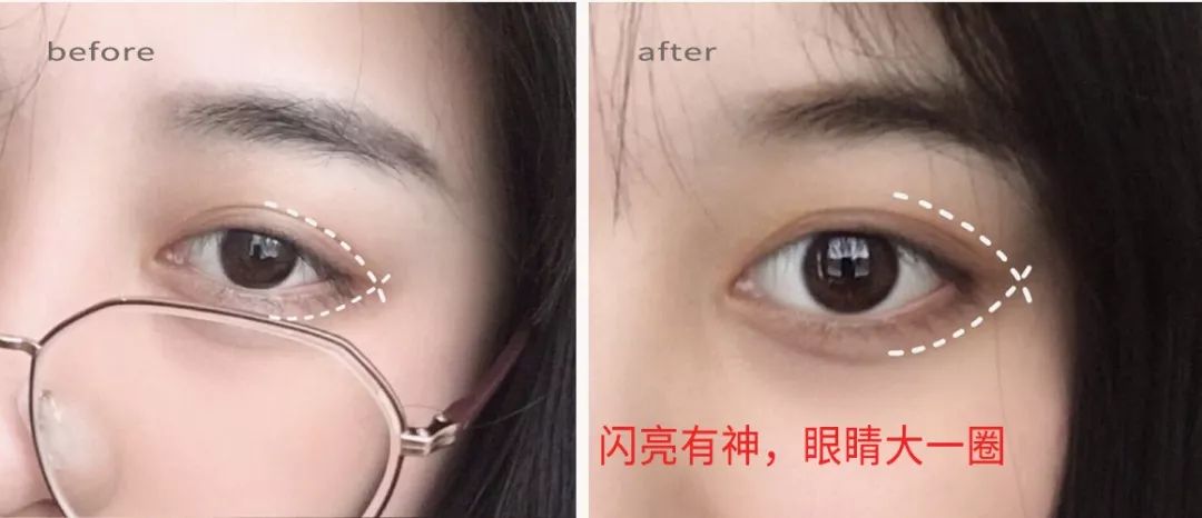 适合熬夜的护眼神器,眼睛劳累用什么护眼神器