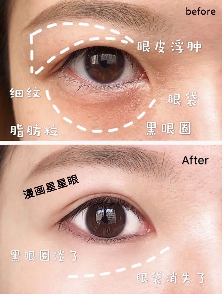 适合熬夜的护眼神器,眼睛劳累用什么护眼神器