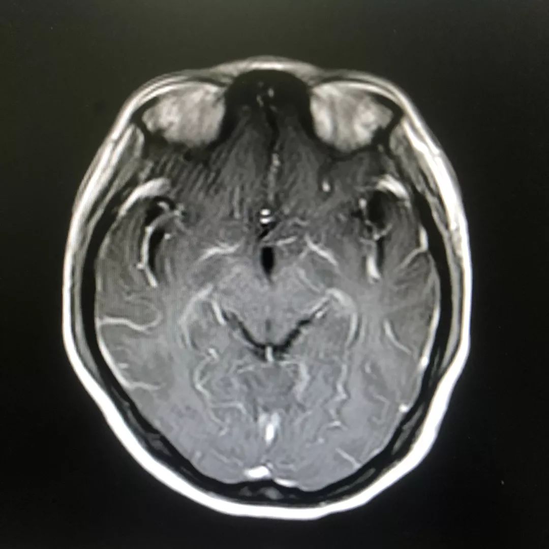 女的经常胡言乱语是什么病,女性胡言乱语疯疯癫癫是怎么回事