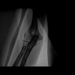 冠脉造影技术成熟不,跟我学技术分析从入门到精通