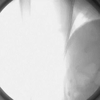 冠脉造影技术成熟不,跟我学技术分析从入门到精通