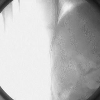 冠脉造影技术成熟不,跟我学技术分析从入门到精通