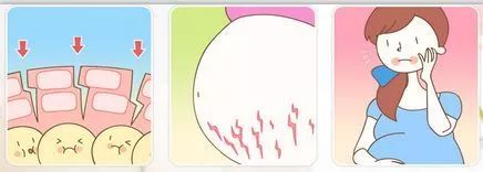 听说准妈妈都怕它，新手妈妈都快被它折磨到抑郁...