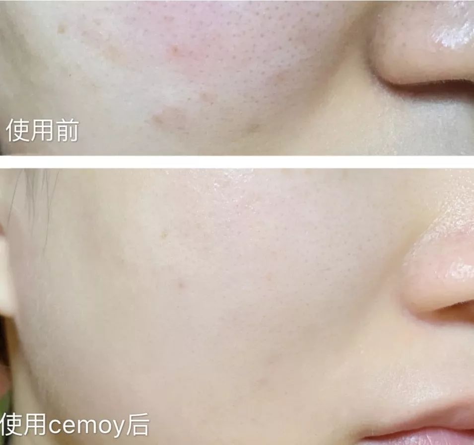 坚决不做“黄脸婆”！有了它，再差的皮肤都有救！丨开团