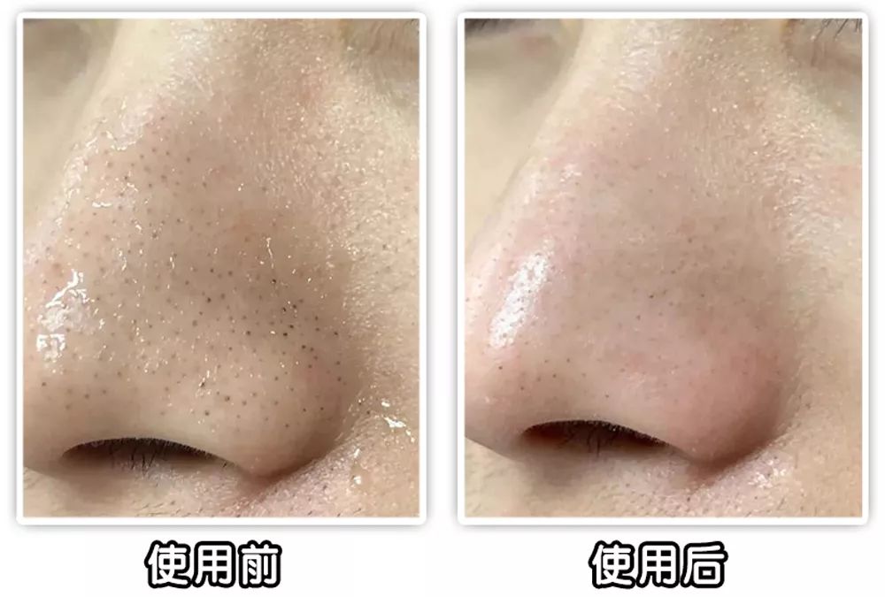 坚决不做“黄脸婆”！有了它，再差的皮肤都有救！丨开团