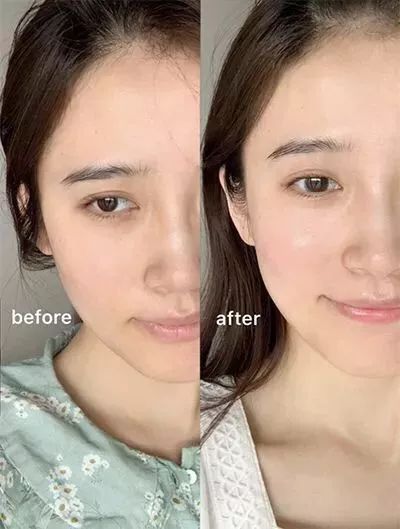 坚决不做“黄脸婆”！有了它，再差的皮肤都有救！丨开团