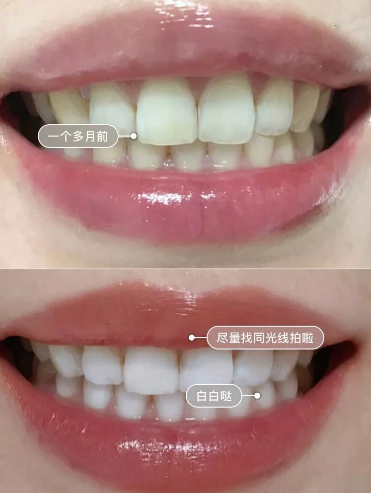 俄罗斯牙膏美白去口臭牙黄,去牙垢黄牙的牙膏测评