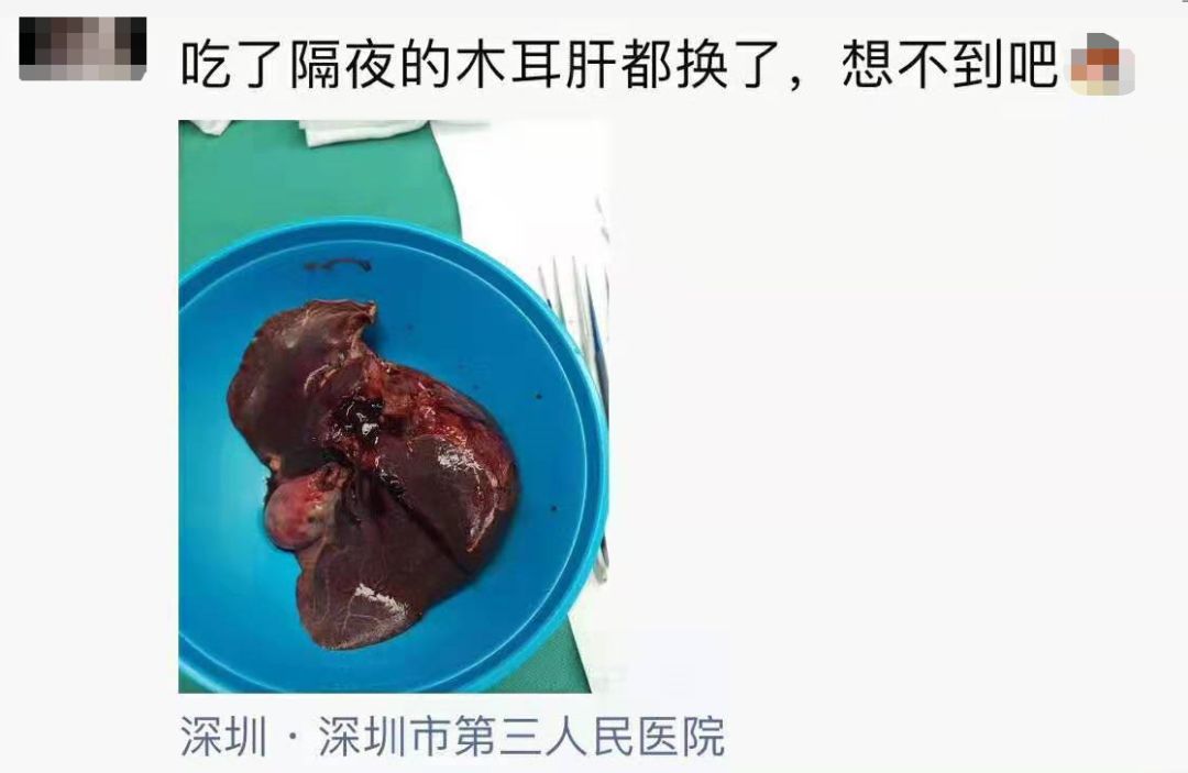 吃了一盘家常菜女子肝脏缩一半,女子吃了这道家常菜肝脏缩了一半