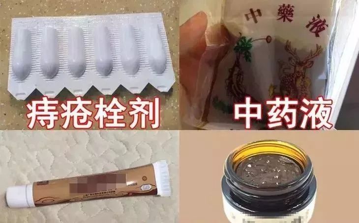 治痔疮最有效的痔疮膏,十多年的痔疮用痔疮膏效果怎么样