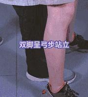 吃东西被噎住自救方法,吃东西噎住自救法