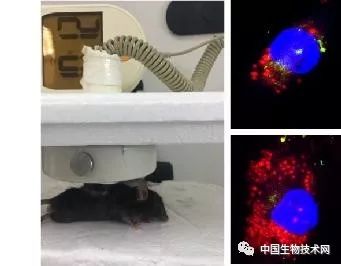 骨关节炎无创治疗新进展：低强度脉冲超声缓解骨关节滑膜炎和自噬相关