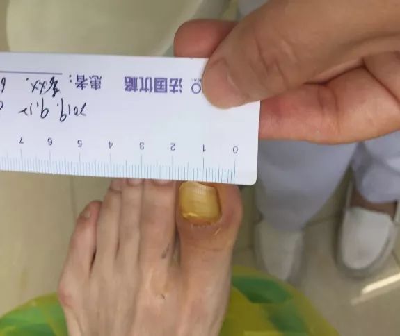 鞋合不合适只有脚知道文案,鞋合适不合适只有脚知道的说说