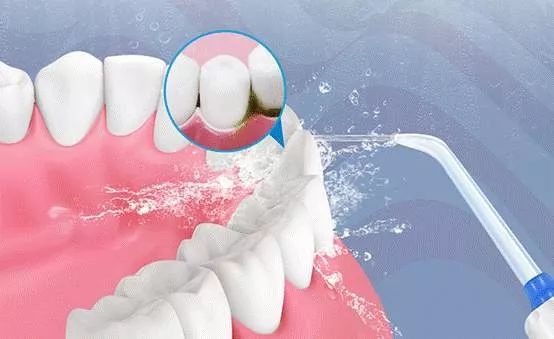 健康吃饭的正确方法,怎么样避免吃饭时塞牙