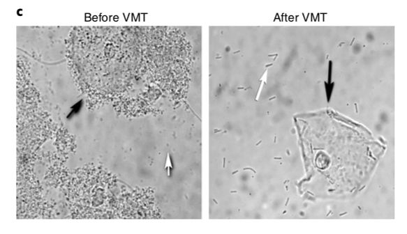 nature子刊抗生素,nature子刊名单