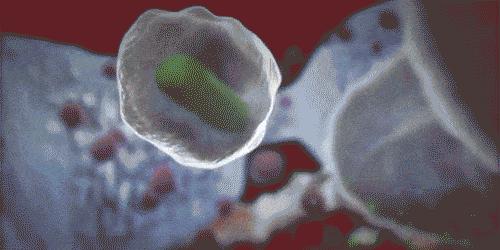 牙龈肿了出血口臭牙黄用什么牙膏,牙龈上火牙膏