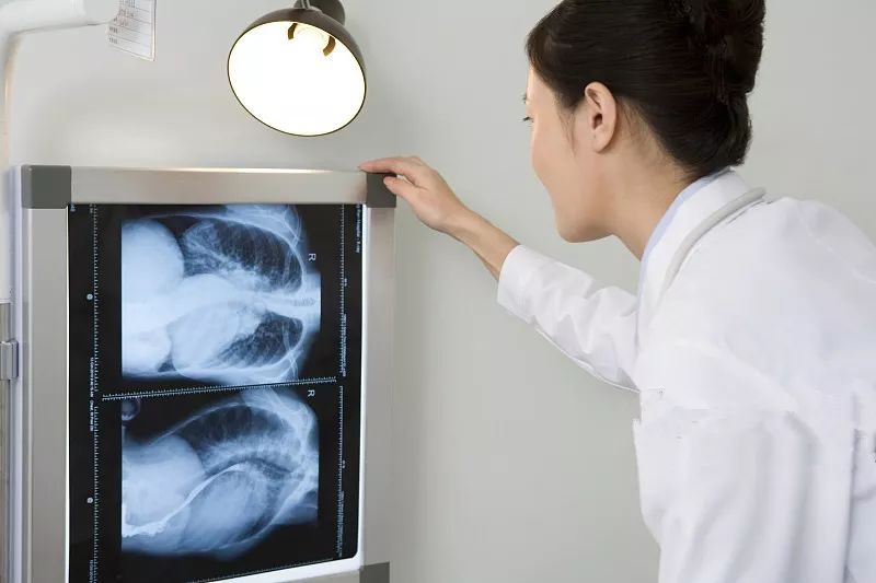 女孩肚子疼医生检查发现罕见怪病,42岁女子腹痛取出肿瘤