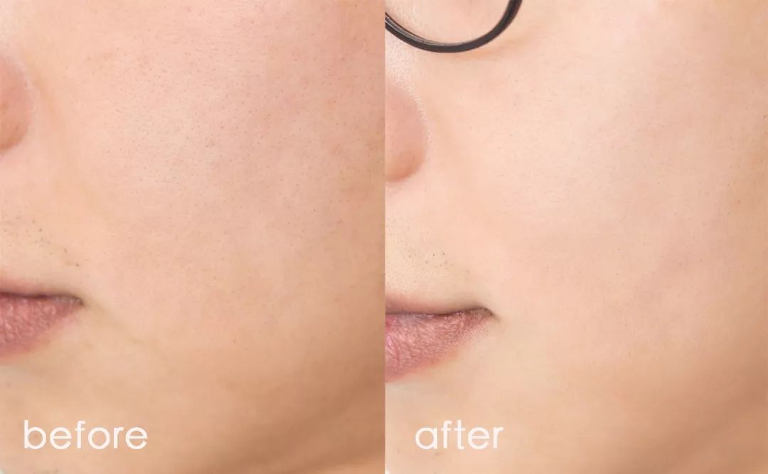 粉丝给我出了个难题该怎么办,美容院把脸整坏了在哪投诉