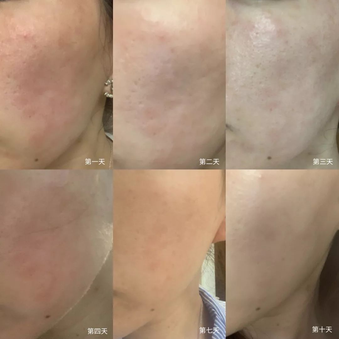 粉丝给我出了个难题该怎么办,美容院把脸整坏了在哪投诉