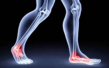 腿疼脚麻走不动可能是血管堵了,腿疼是血管不通畅造成的吗