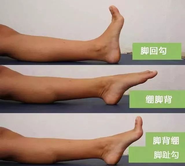 腿疼脚麻走不动可能是血管堵了,腿疼是血管不通畅造成的吗