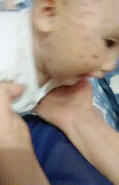 深圳打水痘疫苗免费吗,水痘疫苗哪些城市是免费的