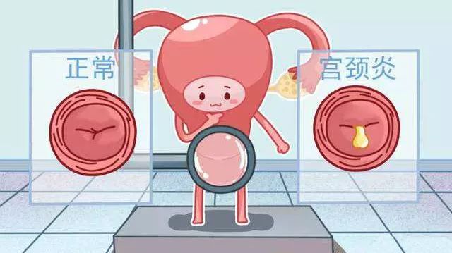 東·科普｜宫颈那些事（一）