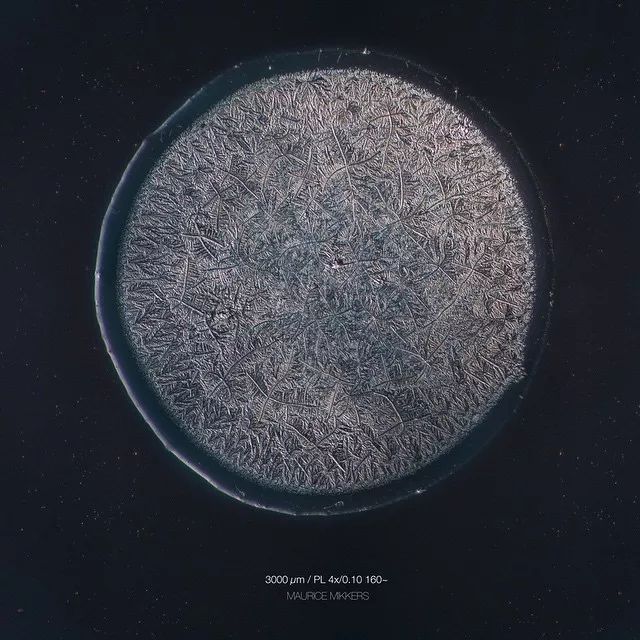 显微镜下的各种眼泪,显微镜下的眼泪原版