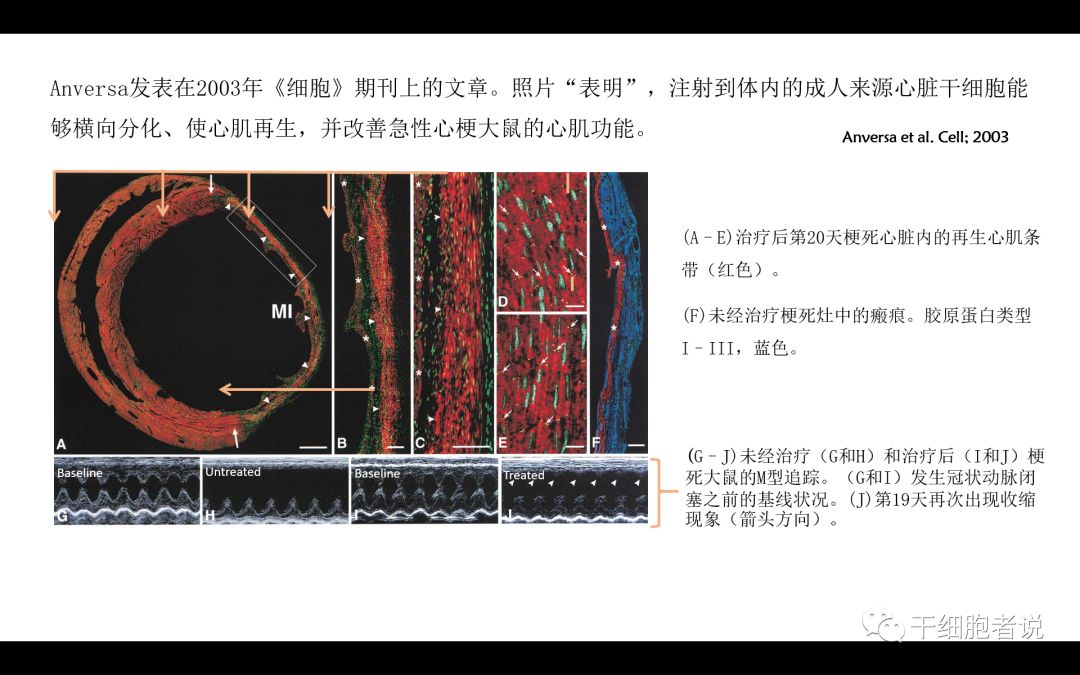 干货：干细胞治疗血汗管疾病的未来（PPT）