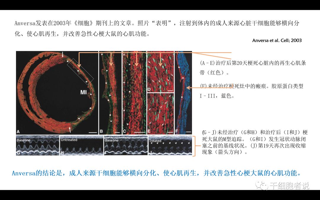 干货：干细胞治疗血汗管疾病的未来（PPT）