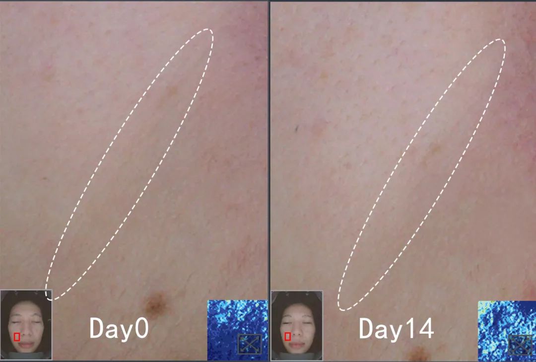 盲测|微整不急!先试试黑科技抗老面霜