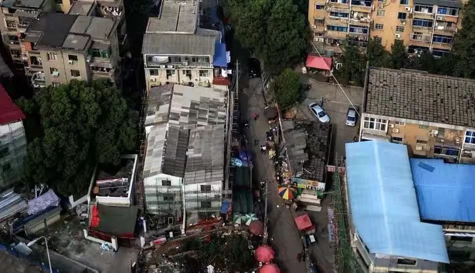 癌症患者挂尿袋和屎袋,患癌人身上带着尿袋