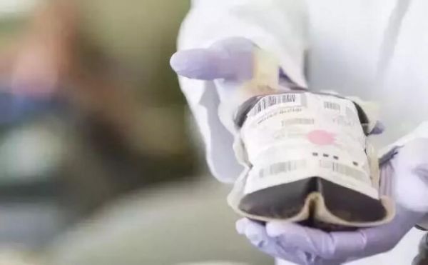 “关艾”①丨艾滋病，不是你想象的那样