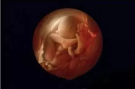 婴儿手脚畸形没查出来,新生儿手指畸形产检医院有责任么