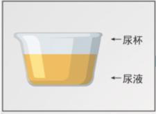 北京疾控中心提醒感染率达87%,北京疾控提醒以下情况人员请报备