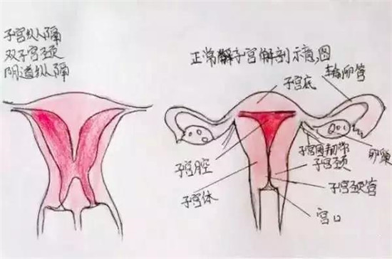 雅安恒博医院提醒：子宫有这道“墙”需及时“拆除”