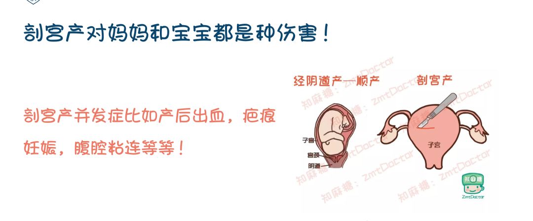 生孩子怎么不痛苦,生孩子怎么不痛