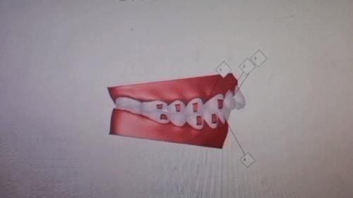 种牙免费送,种牙优惠活动免费检查是真的吗