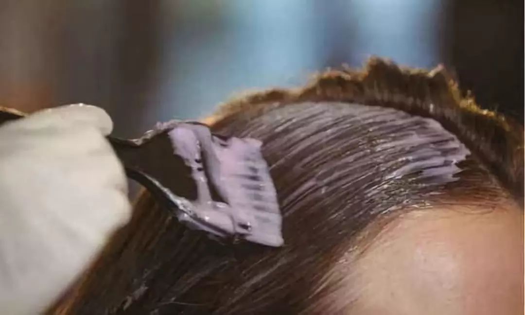 眼睛肿成缝，头皮溃烂…一周接诊20多例！年前干这事的荆门人要关注了