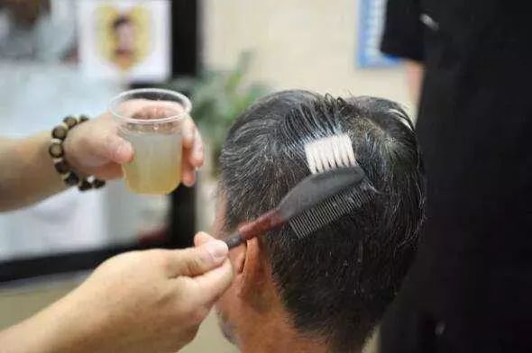 眼睛肿成缝，头皮溃烂…一周接诊20多例！年前干这事的荆门人要关注了