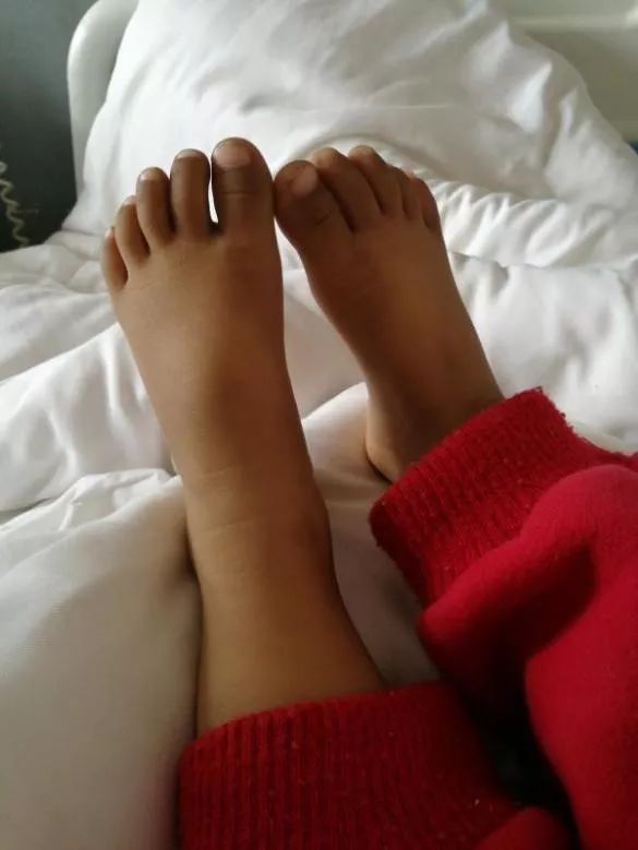 四期转移、半年复发、耐药、转院，患生殖细胞瘤的丫丫终踏上幼儿园之路