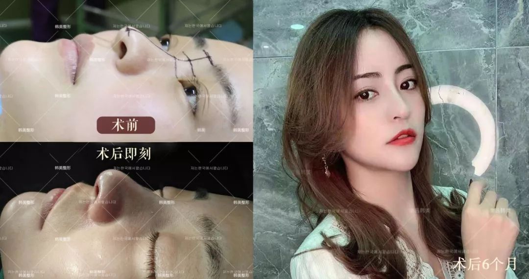 最新消息！5月20日起！为期5天