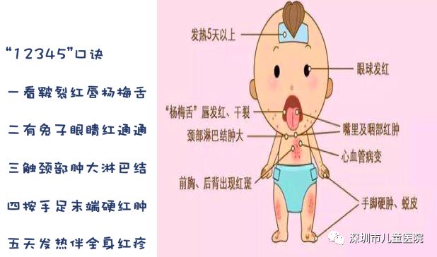 医生说小感冒要重视,本以为是普通感冒结果差点没命