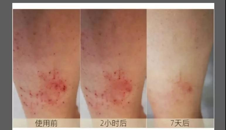 防干燥瘙痒的身体乳精油,皮肤干燥痒身体乳评测