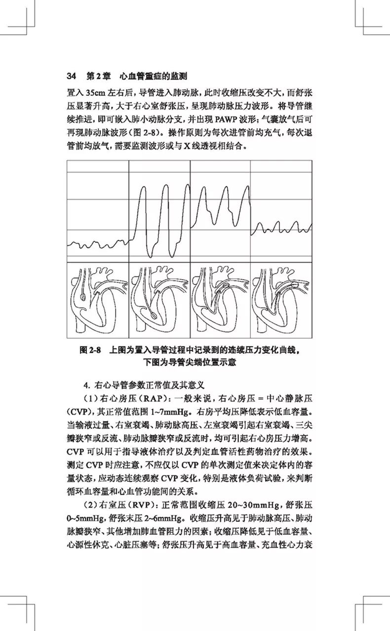 阜外医院血汗管专家讲血汗管视频,阜外血汗管最新治疗手段