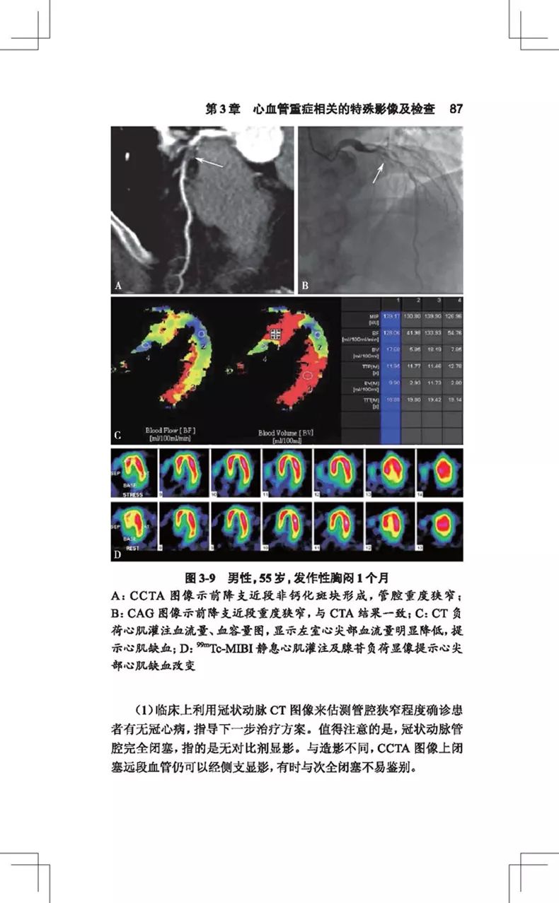 阜外医院血汗管专家讲血汗管视频,阜外血汗管最新治疗手段