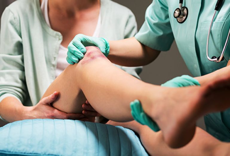 身上出青紫斑还有点疼,身上有块青紫色怎么回事