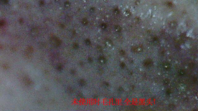 洗完脸后脸部还是能擦出脏东西,洗完脸后才知道脸上这么脏