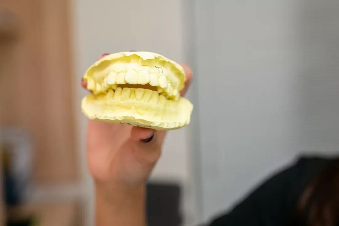 种牙免费送,种牙优惠活动免费检查是真的吗