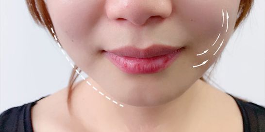 洗完脸后脸部还是能擦出脏东西,洗完脸后才知道脸上这么脏