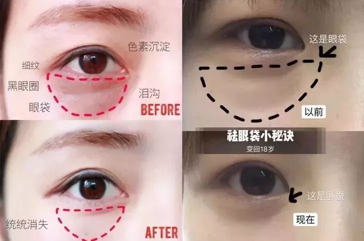 马应龙水晶眼膜视频,马应龙八宝多肽眼膜